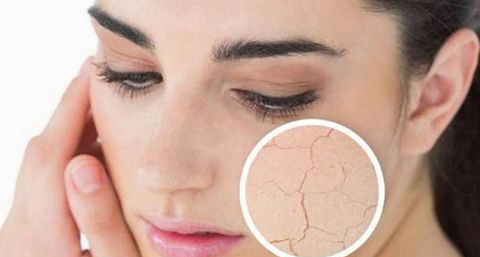 脱毛膏除汗毛好吗_祛汗毛用什么方法