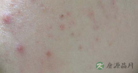 西瓜皮炒什么好吃