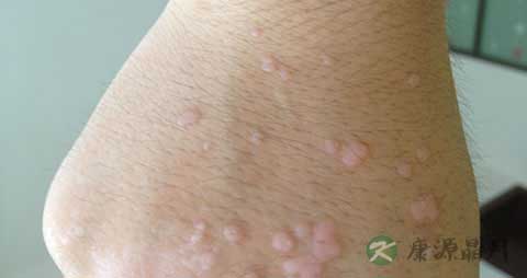 生马齿苋能泡水喝吗