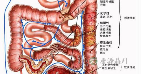 肠息肉