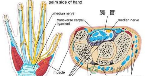 腕管综合征