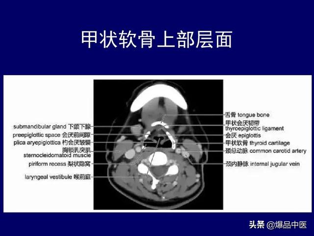 影像解剖 | 颈部影像解剖