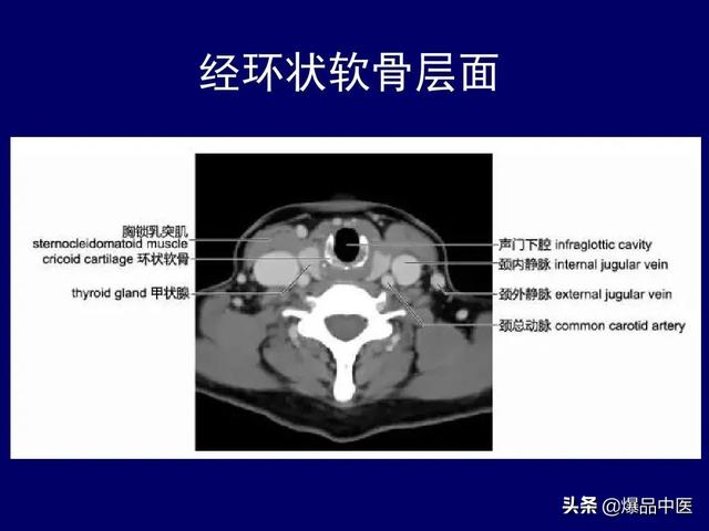 影像解剖 | 颈部影像解剖