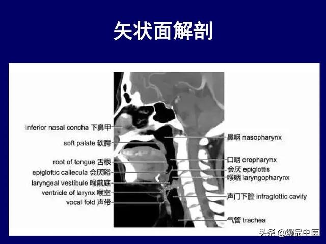 影像解剖 | 颈部影像解剖