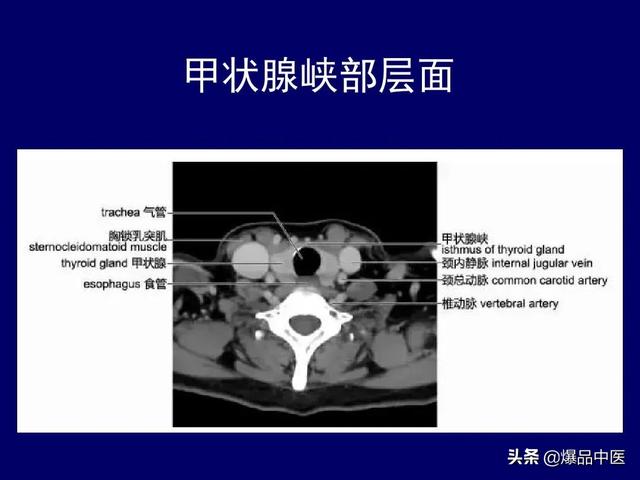 影像解剖 | 颈部影像解剖