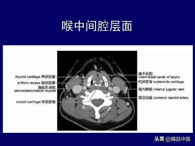 影像解剖 | 颈部影像解剖