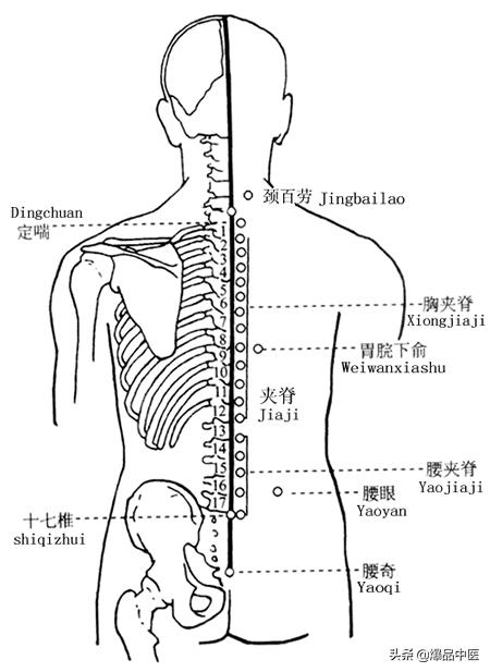 各种疼痛的针灸治疗穴位