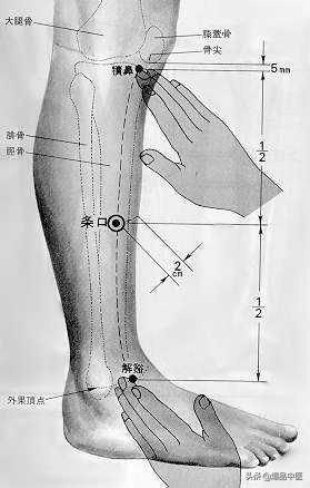 各种疼痛的针灸治疗穴位