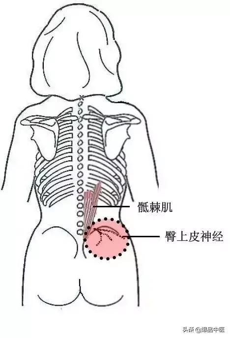 软组织常见压痛点