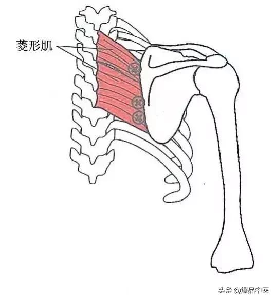 软组织常见压痛点