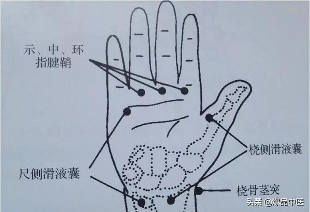 干货 | 疼痛科每位医生需要的一把“利剑”