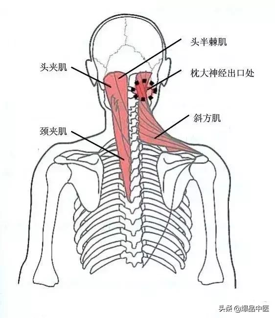 软组织常见压痛点