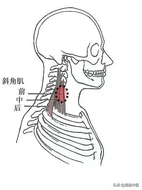 软组织常见压痛点