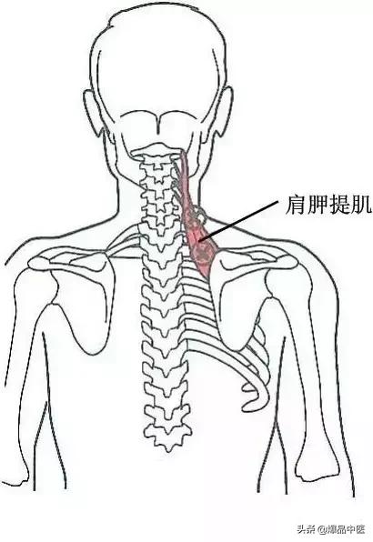 软组织常见压痛点