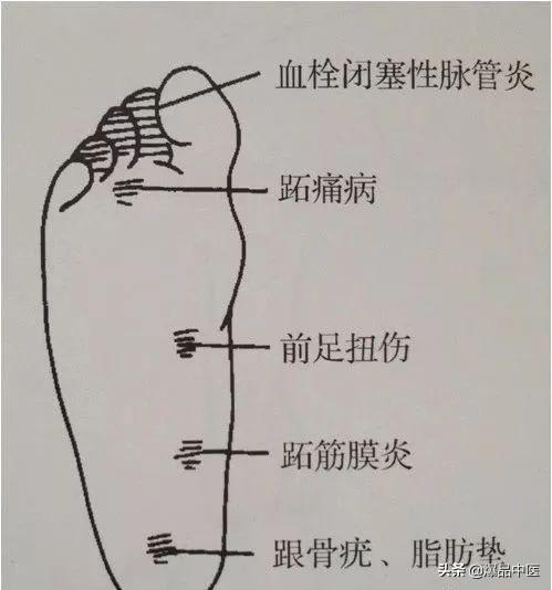 干货 | 疼痛科每位医生需要的一把“利剑”