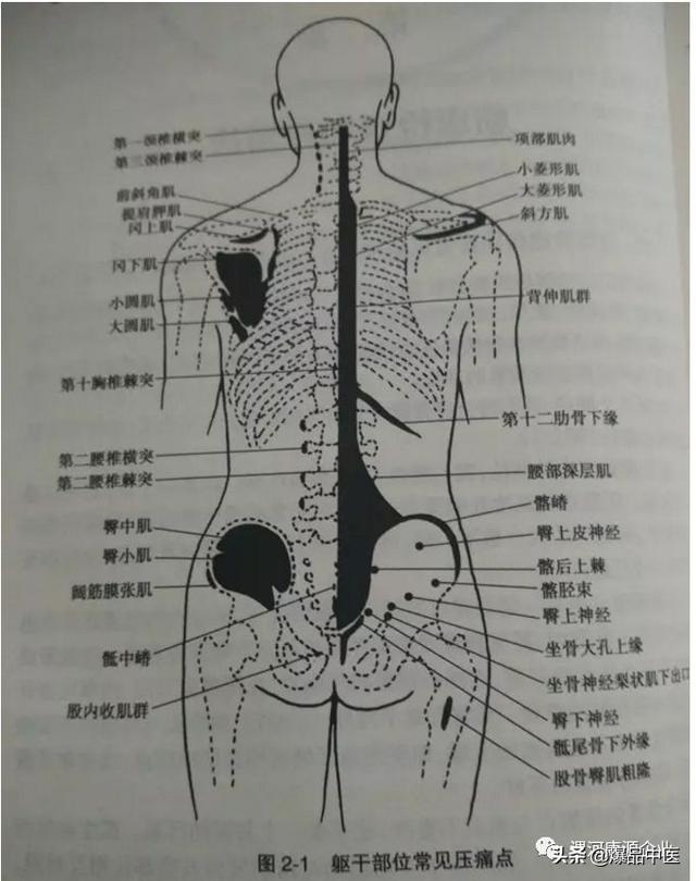 软组织常见压痛点