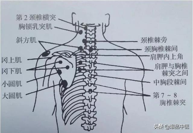 干货 | 疼痛科每位医生需要的一把“利剑”