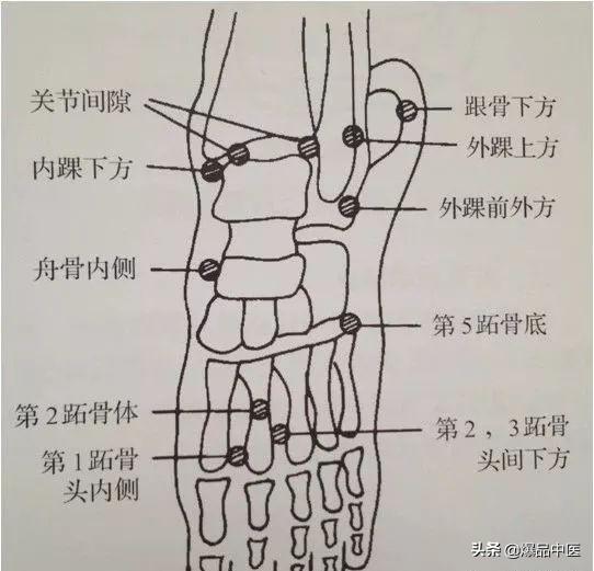 干货 | 疼痛科每位医生需要的一把“利剑”