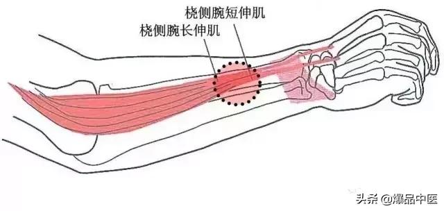 软组织常见压痛点