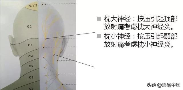 干货 | 疼痛科每位医生需要的一把“利剑”