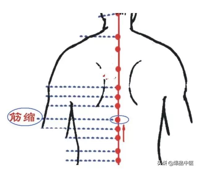 88个精选穴，专穴专用