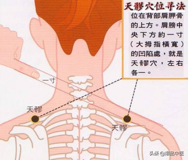 颈椎间盘突出引起手肩麻的治疗穴位