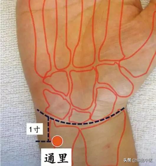 高清图解！针灸常用22个奇穴盘点，内含取穴方，值得一看