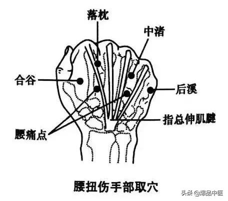 治疗腰扭伤，这几招特别管用