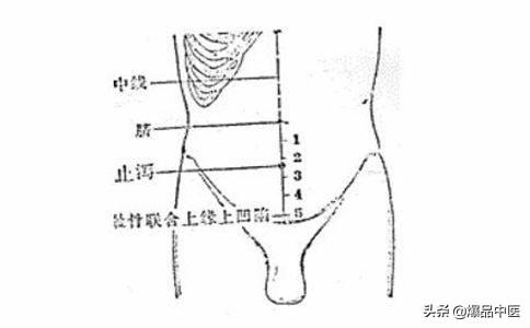 高清图解！针灸常用22个奇穴盘点，内含取穴方，值得一看