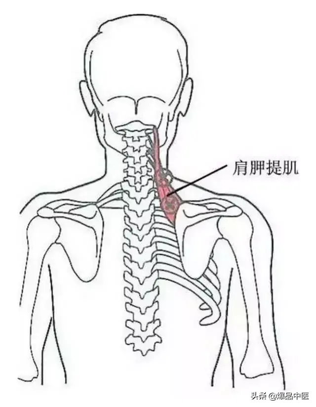 颈肩病常见的几个压痛点！治疗颈肩不适，经典好文章