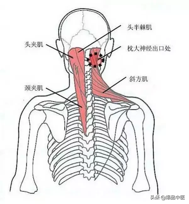 颈肩病常见的几个压痛点！治疗颈肩不适，经典好文章