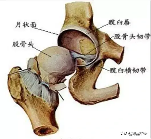 股骨头坏死的诊断与治疗策略，康源干货分享