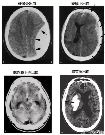 神经系统一天搞定，打破死板记忆方法