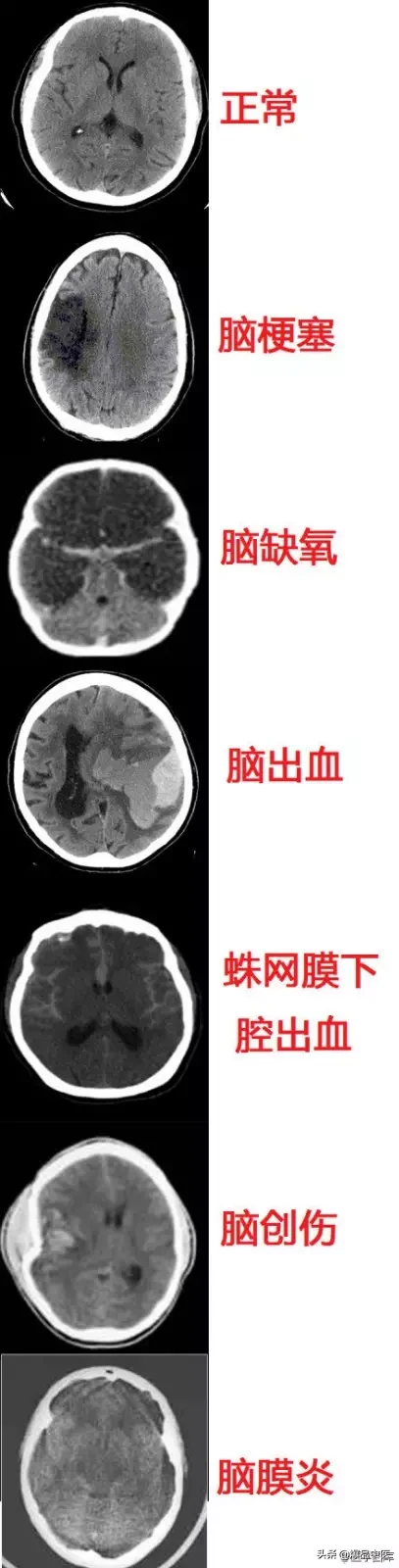 神经系统一天搞定，打破死板记忆方法