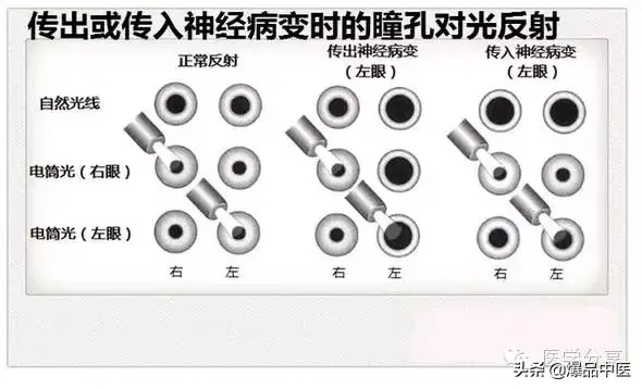 神经系统一天搞定，打破死板记忆方法