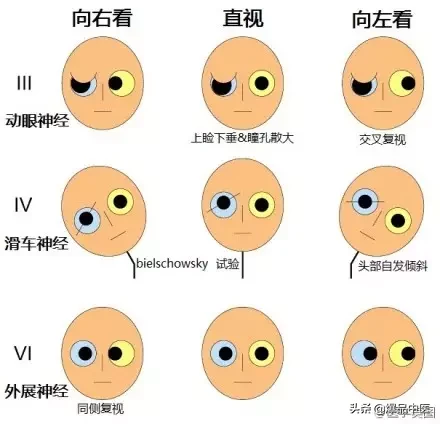 神经系统一天搞定，打破死板记忆方法