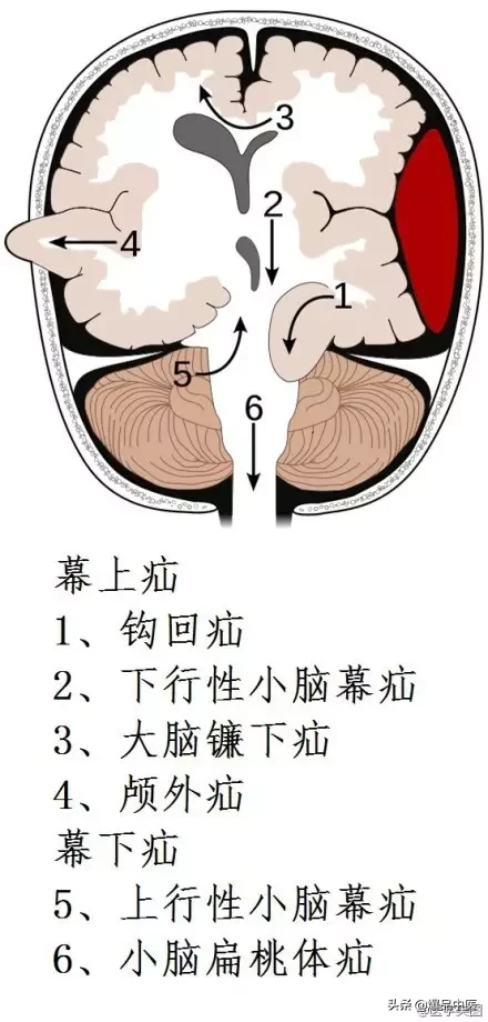 神经系统一天搞定，打破死板记忆方法