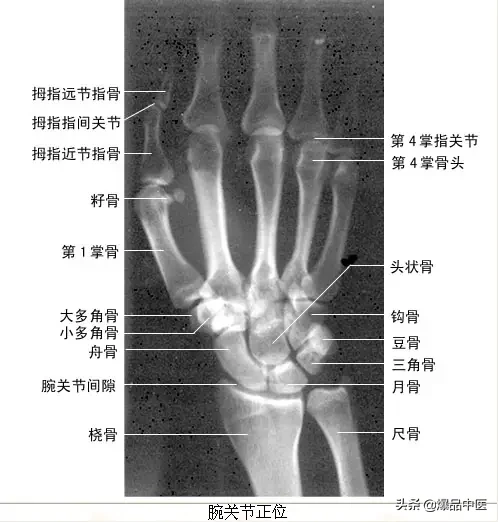 正常Ｘ线解剖