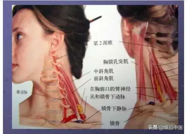 颈项部肌肉基础解剖——起止点及作用