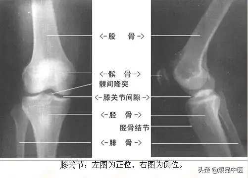 正常Ｘ线解剖