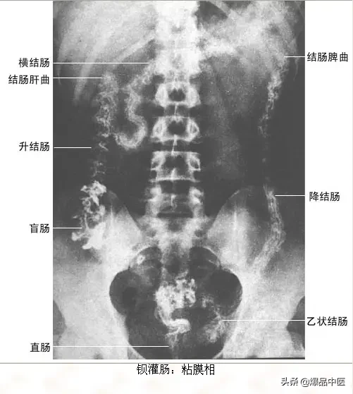 正常Ｘ线解剖