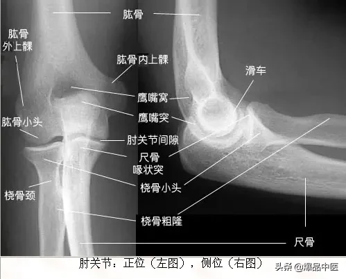 正常Ｘ线解剖