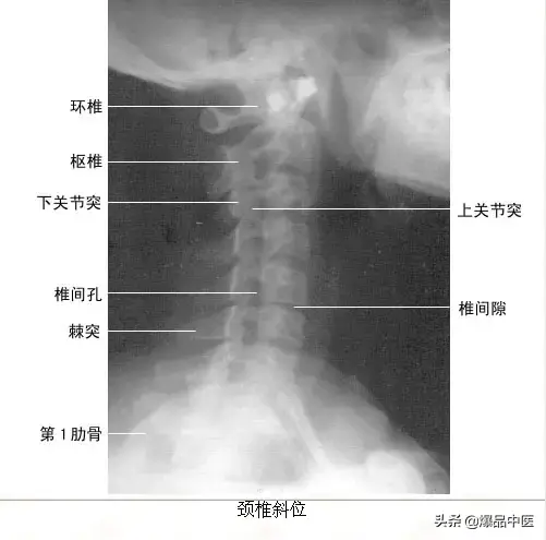 正常Ｘ线解剖