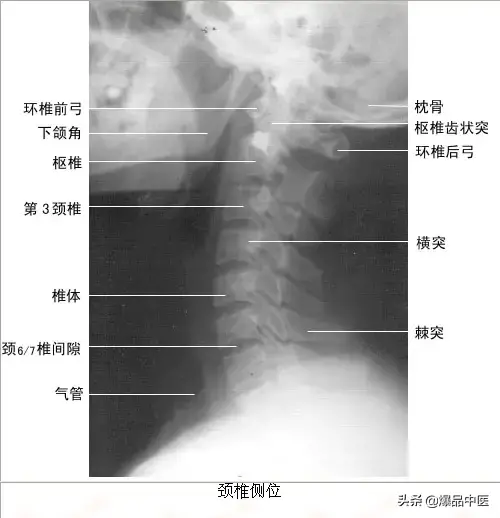 正常Ｘ线解剖