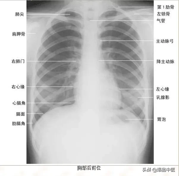 正常Ｘ线解剖