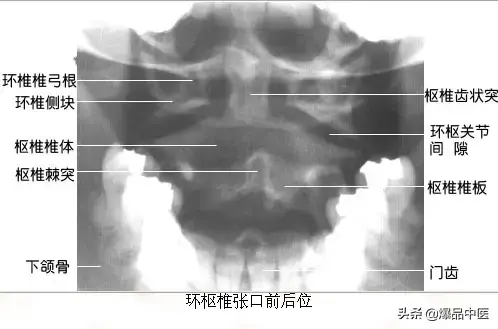 正常Ｘ线解剖