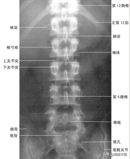 正常Ｘ线解剖