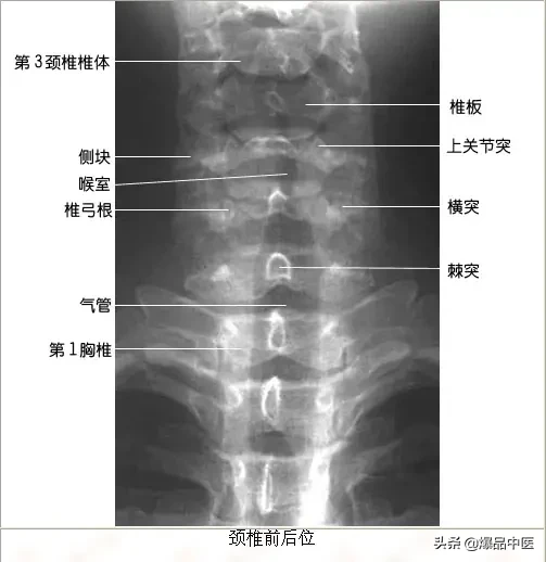 正常Ｘ线解剖