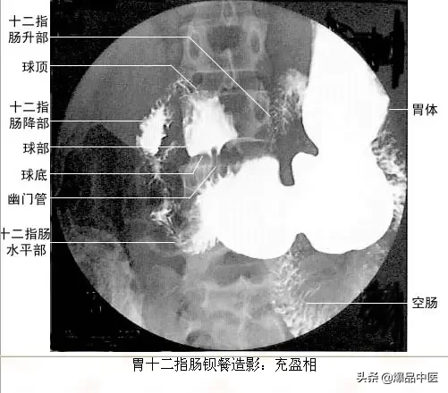 正常Ｘ线解剖