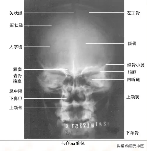 正常Ｘ线解剖